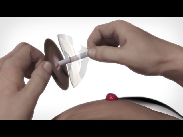 Conseal Plug
