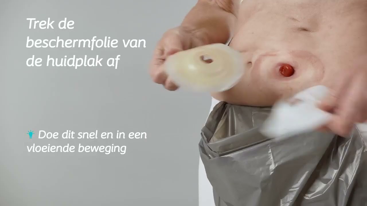 SenSura Mio Convex met plakkoppeling gesloten